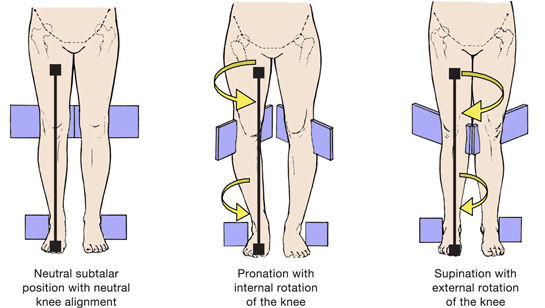 knee fig 3