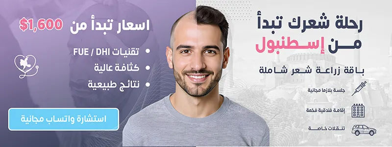 زراعة شعر 2 عربي
