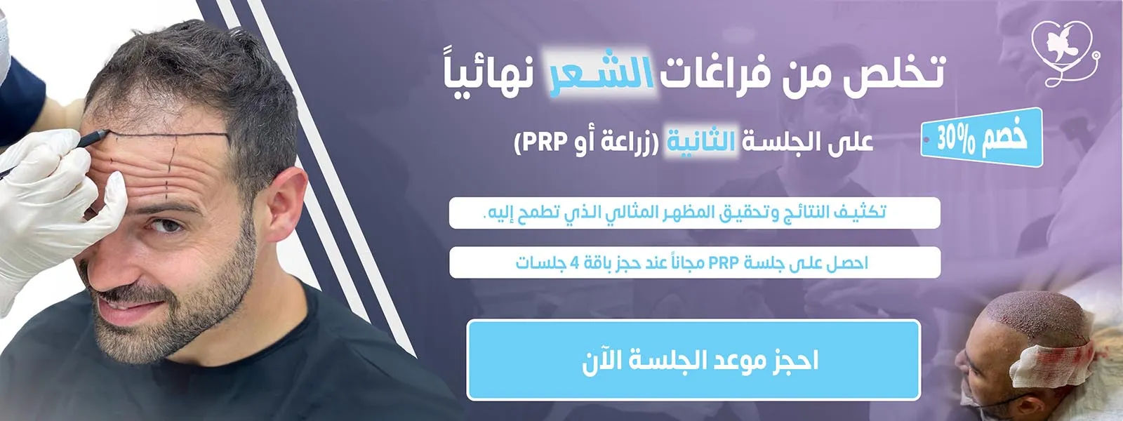 زراعة شعر 1 عربي
