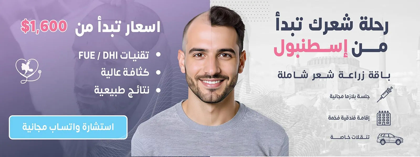 زراعة شعر 2 عربي