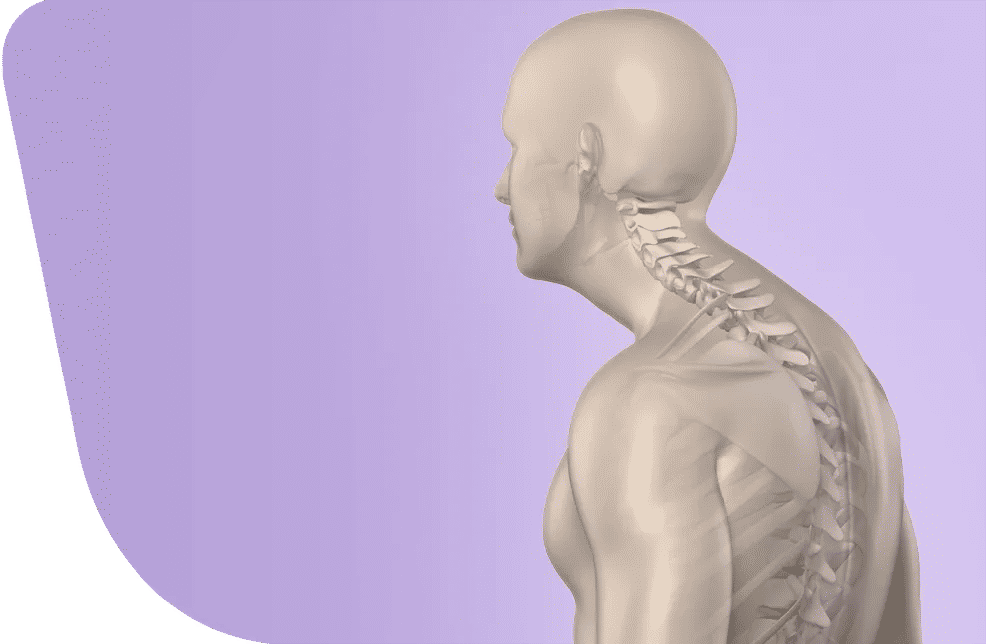 Chirurgie de la cyphose