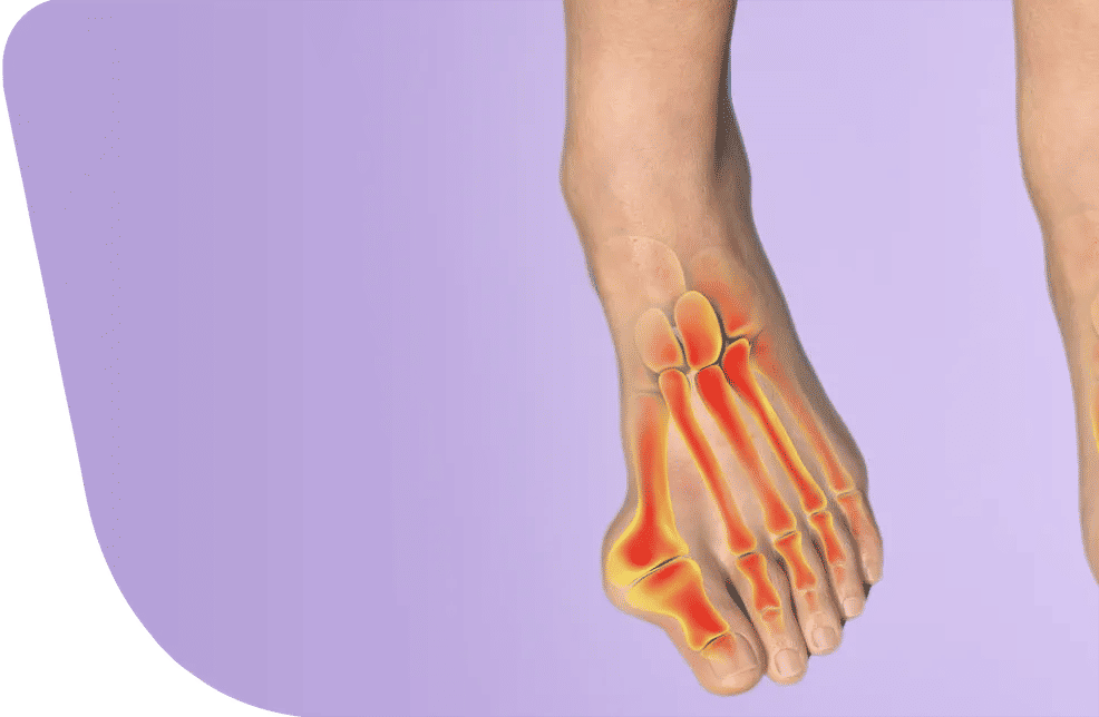 Bone Deformities Surgery