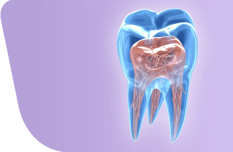 Traitement endodontique