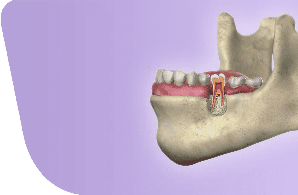 Fibula Free Flap Surgery
