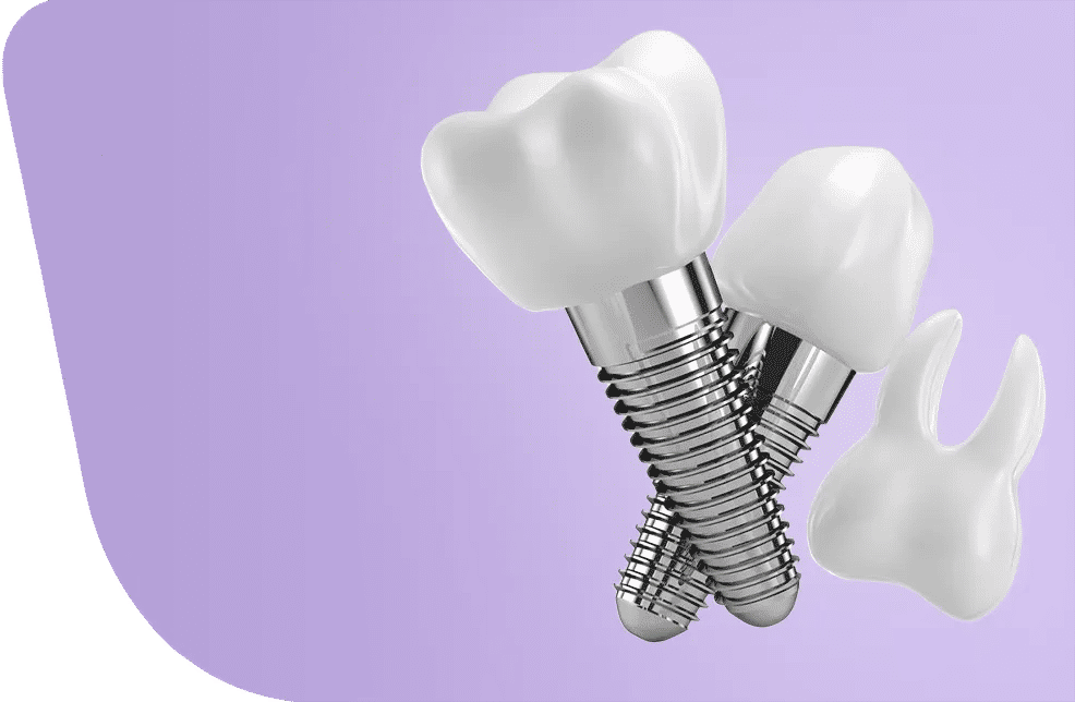 Implant dentaire