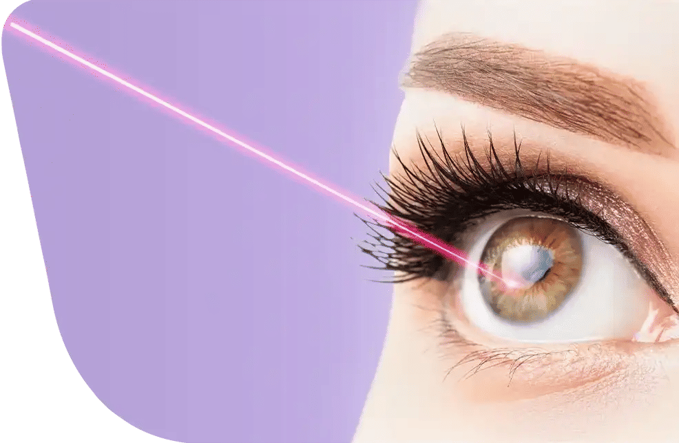 LASIK Eye Surgery