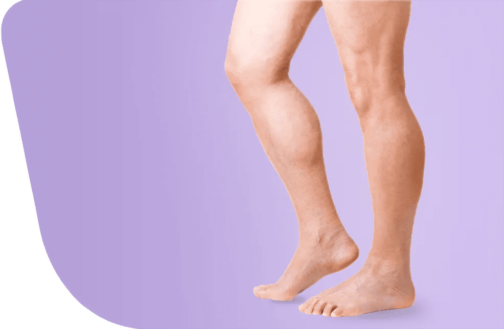 Limb Lengthening Surgery