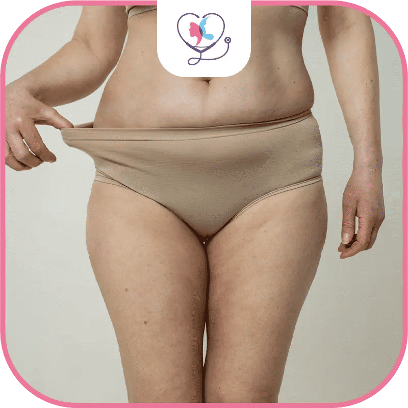 فشل عملية شفط الدهون