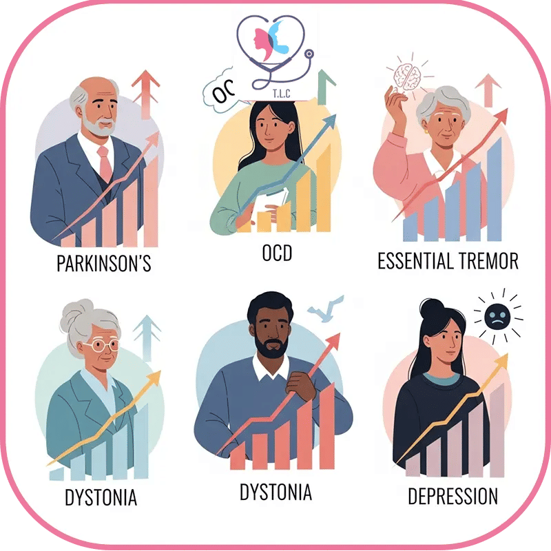 التحفيز العميق للدماغ