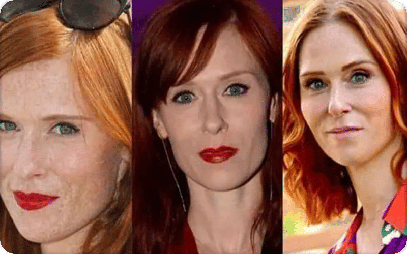 Audrey Fleurot a-t-elle fait de la chirurgie esthétique ?