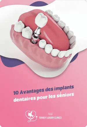 10 Avantages des implants dentaires pour les séniors