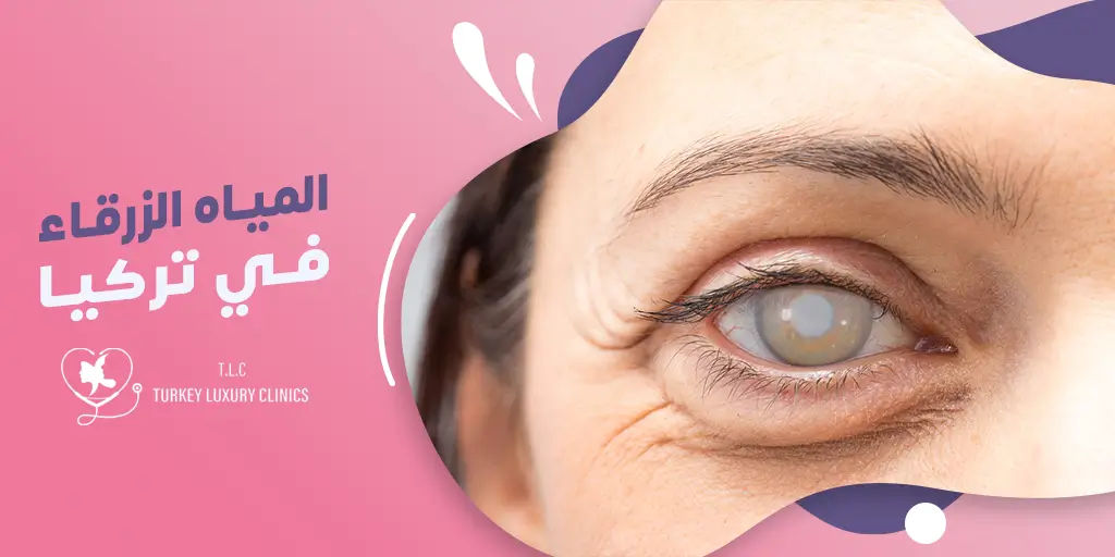 عملية المياه الزرقاء