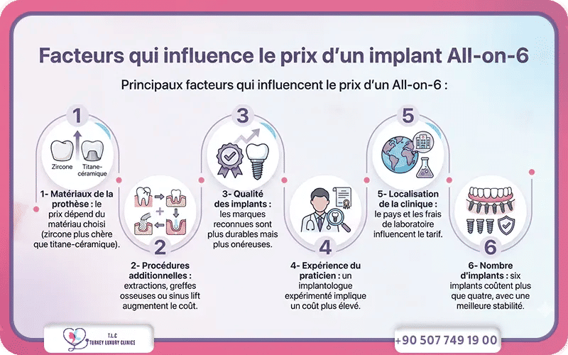 Facteurs qui influence le prix d’un implant All-on-6