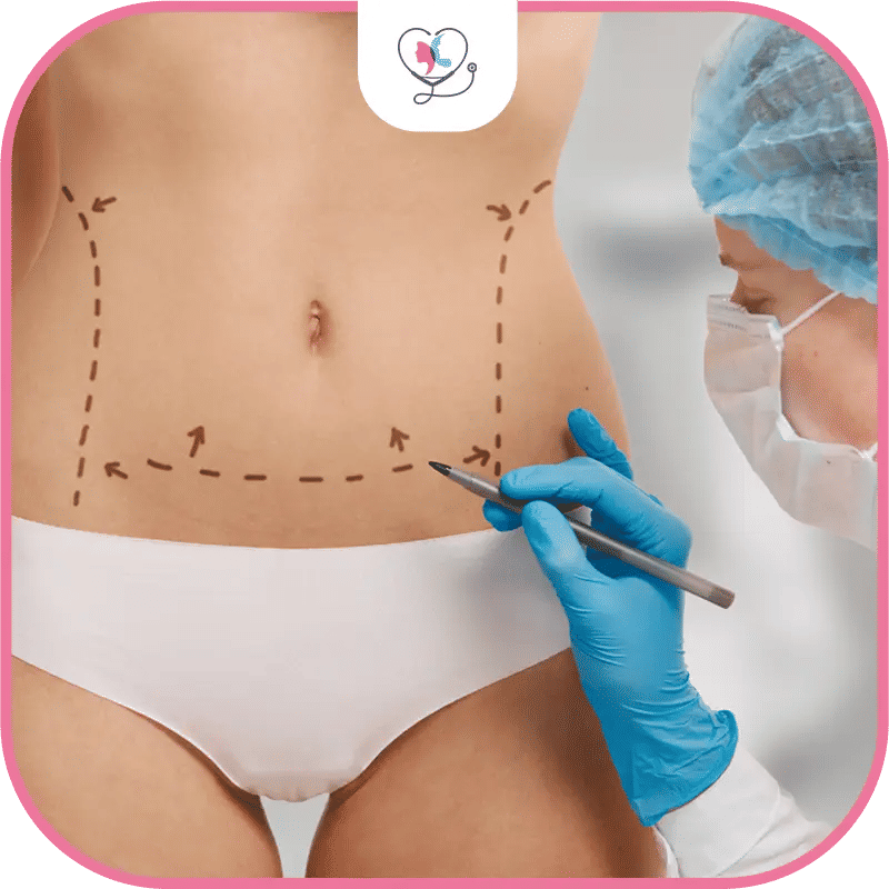 خطوات عملية شفط الدهون مع تركيا لاكشري كلينك