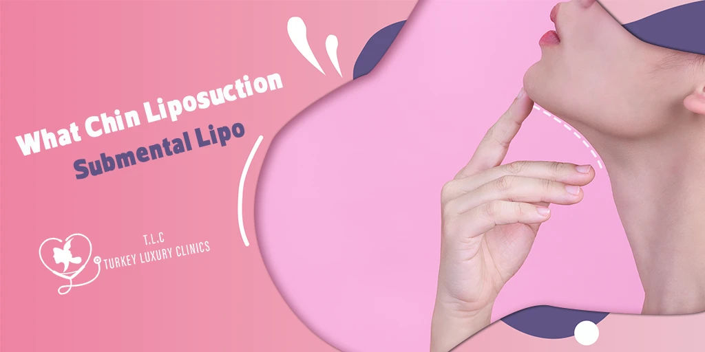 Chin Liposuction (Submental Lipo): Cost, Recovery & Results 2026