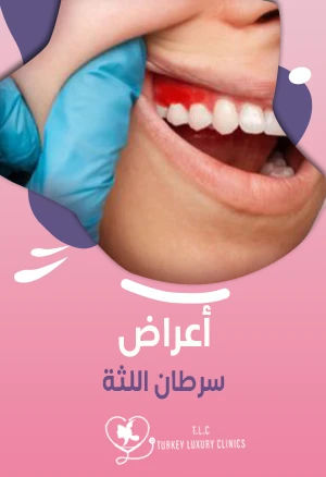 أعراض سرطان اللثة: العلاج مع الصور والأسعار