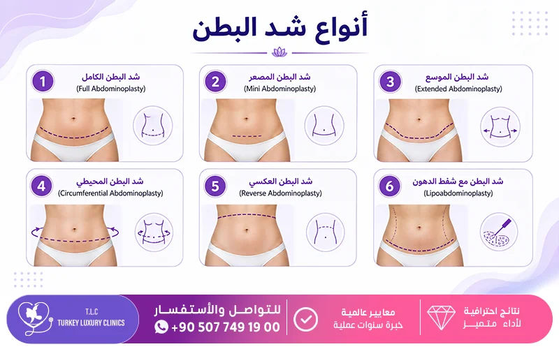 أنواع شد البطن