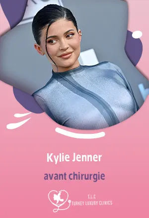 Kylie Jenner avant chirurgie : évolution, rumeurs et réalitéfeatured image