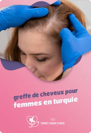 Greffe de cheveux pour femmes en Turquie