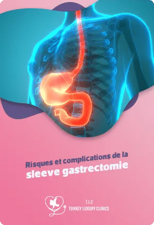 Risques et complications de la sleeve gastrectomie
