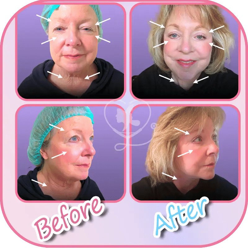 ثالثاً: خبرة الجراح