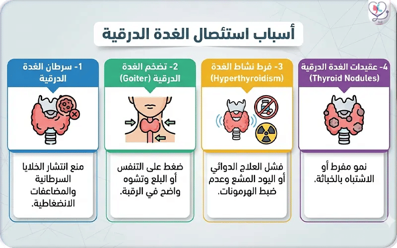 أسباب استئصال الغدة الدرقية