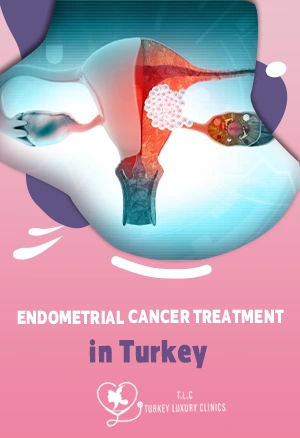 Endometrial Cancer Treatment in Turkey: 2026 Prices,Treatments & Success Rate