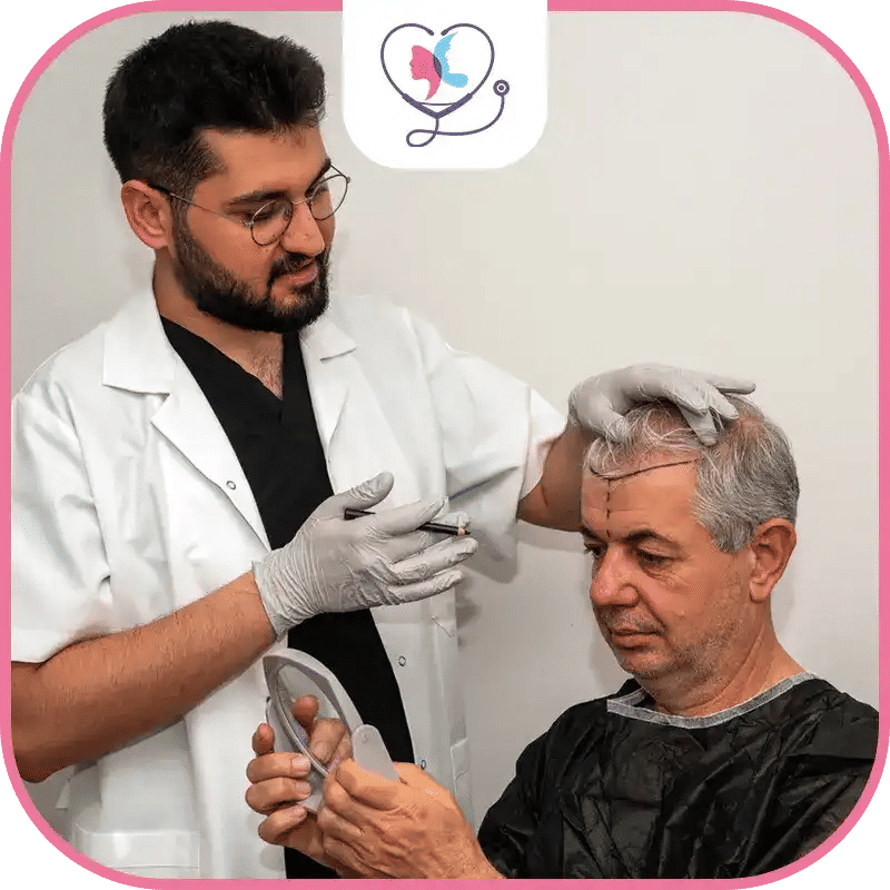 زراعة الشعر في تركيا