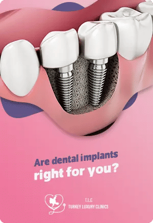 Are dental implants right for you? Understanding the benefits and considerations