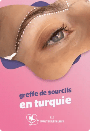 La greffe de sourcils en Turquie