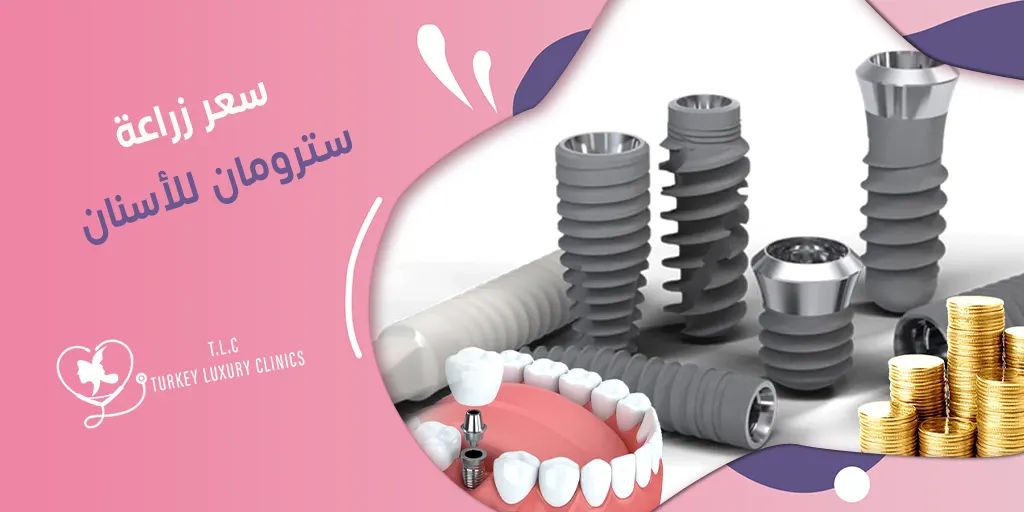 سعر زراعة سترومان للأسنان: تركيا والسعودية وباقي الدول