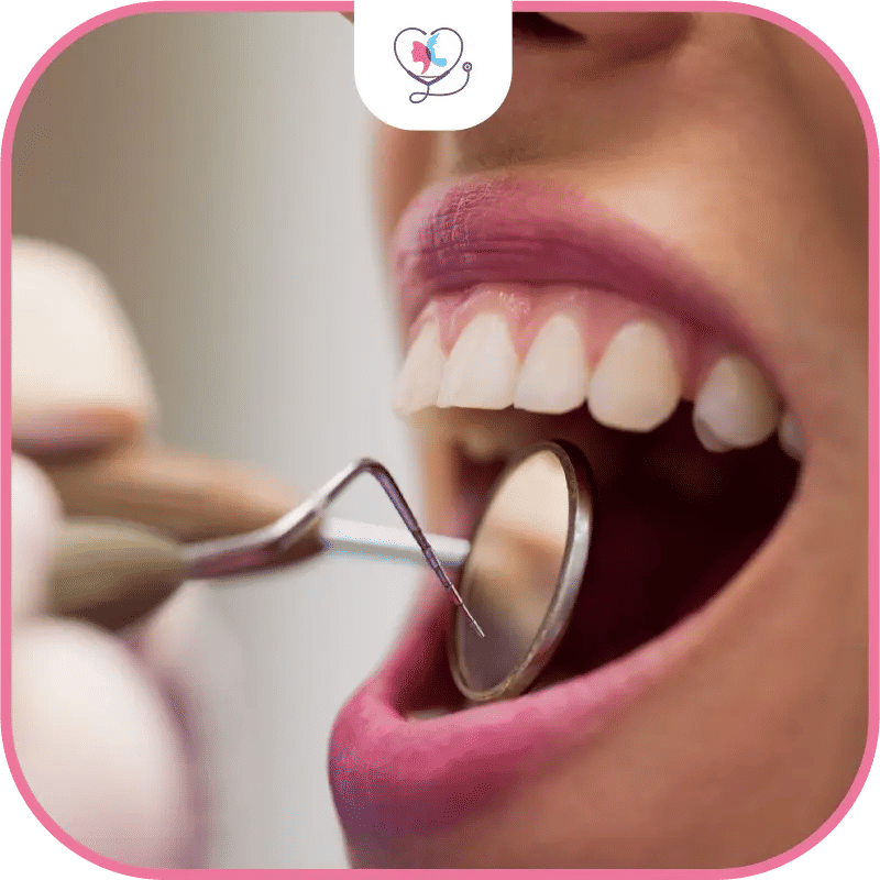 Comment entretenir des bridges en céramique ?