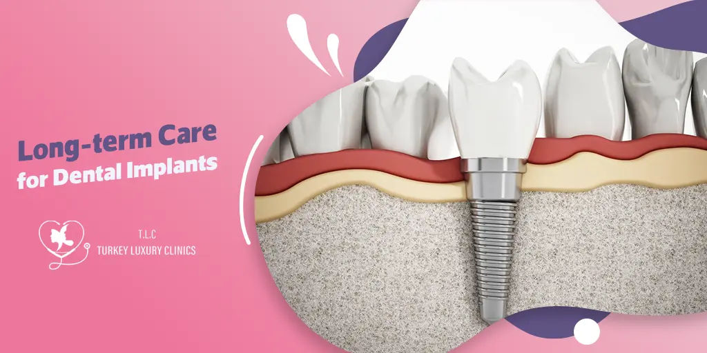 Long-term Care for Dental Implants