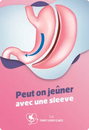 Peut on jeûner avec une sleeve : Conseils et précautions