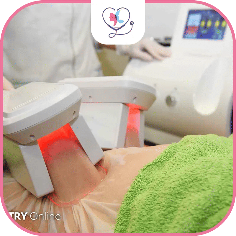 Déroulement d'une séance de cryolipolyse