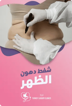 شفط دهون الظهرfeatured image