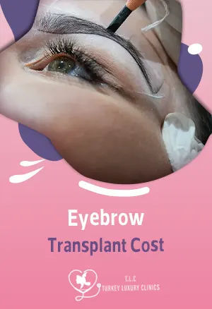 Augenbrauen-Transplantation Kosten: Preise 2026featured image