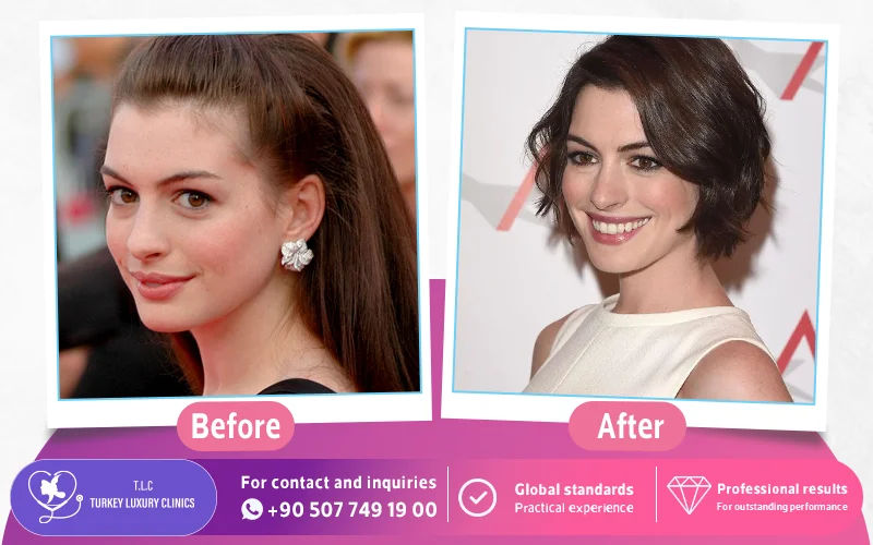 Anne Hathaway 2010 2015