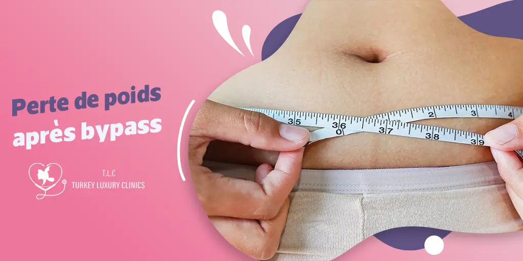Perte de poids après bypass : Étapes et recommandations essentielles