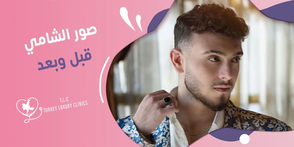 صور الشامي قبل وبعد: من 140 إلى النحافة بعد عملية قص المعدة