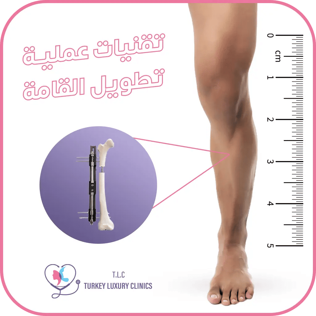 عملية زيادة الطول