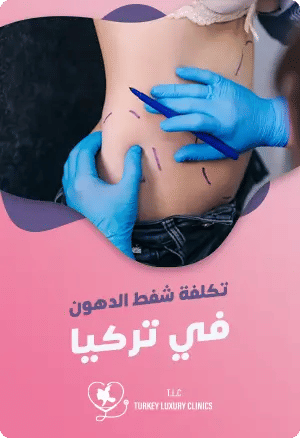 تكلفة شفط الدهون في تركيا: ماذا تشمل والمزايا؟