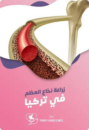 زراعة نخاع العظم في تركيا: دليك الشاملfeatured image