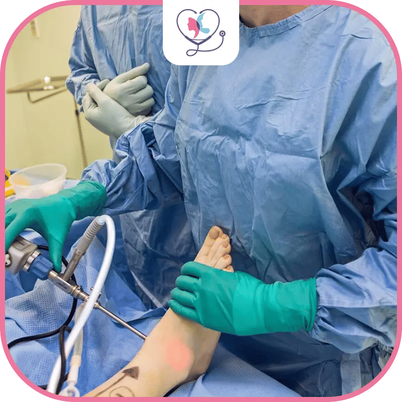 تنظير مفصل الكاحل في تركيا