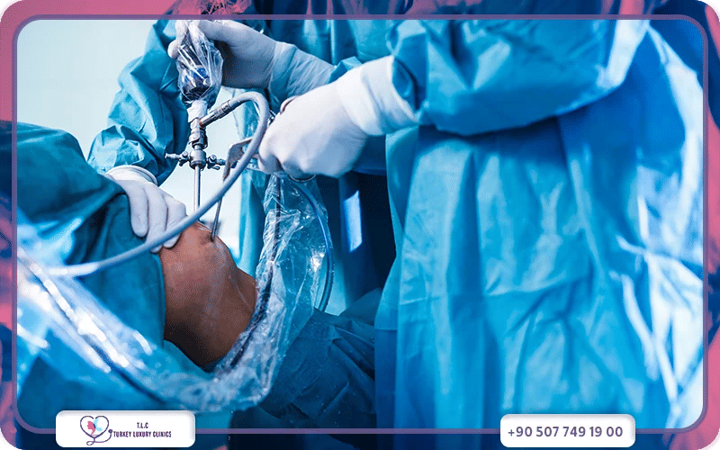 ثانياً: العلاج الجراحي