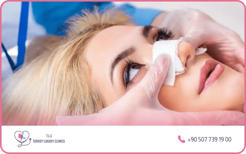 Quel est le tarif d’une rhinoplastie de la pointe du nez ?