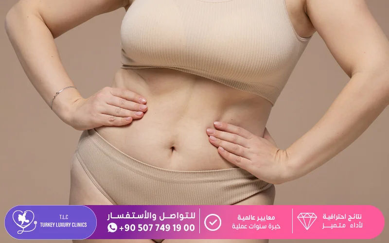 ما هي عملية شد البطن؟