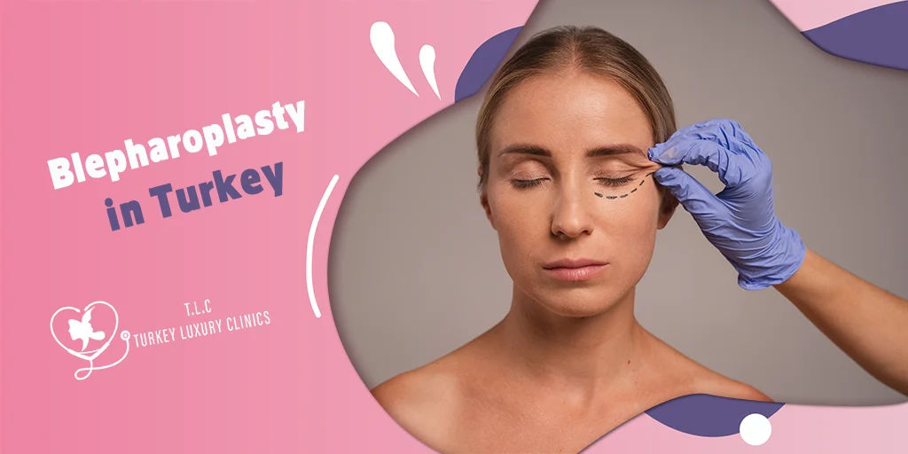 Blepharoplasty in Turkey (2026): Cost, Best Surgeons, Recovery & Before and After