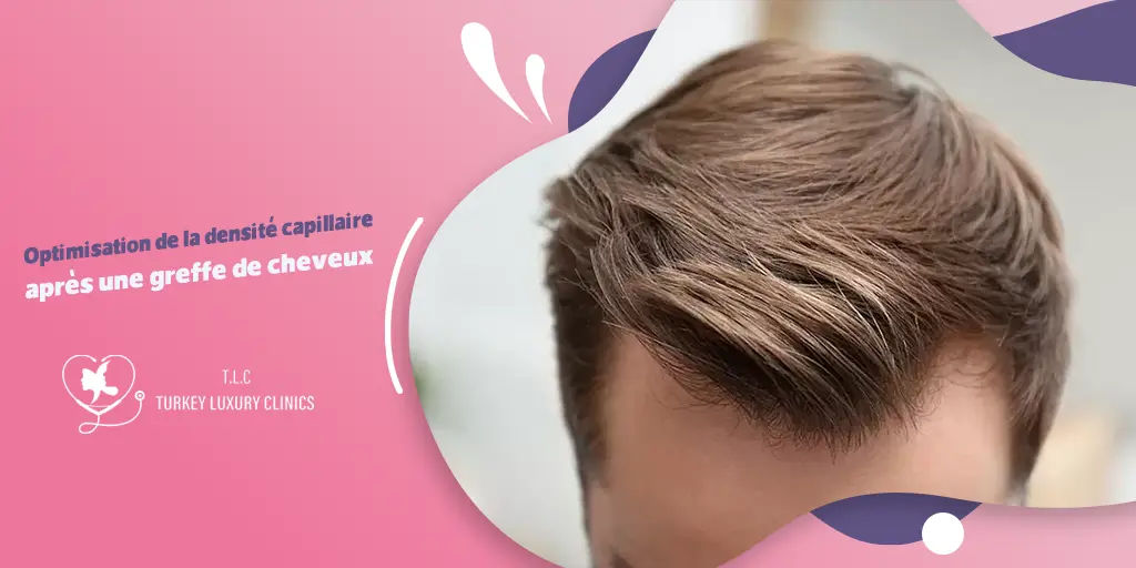Optimisation de la densité capillaire après une greffe de cheveux