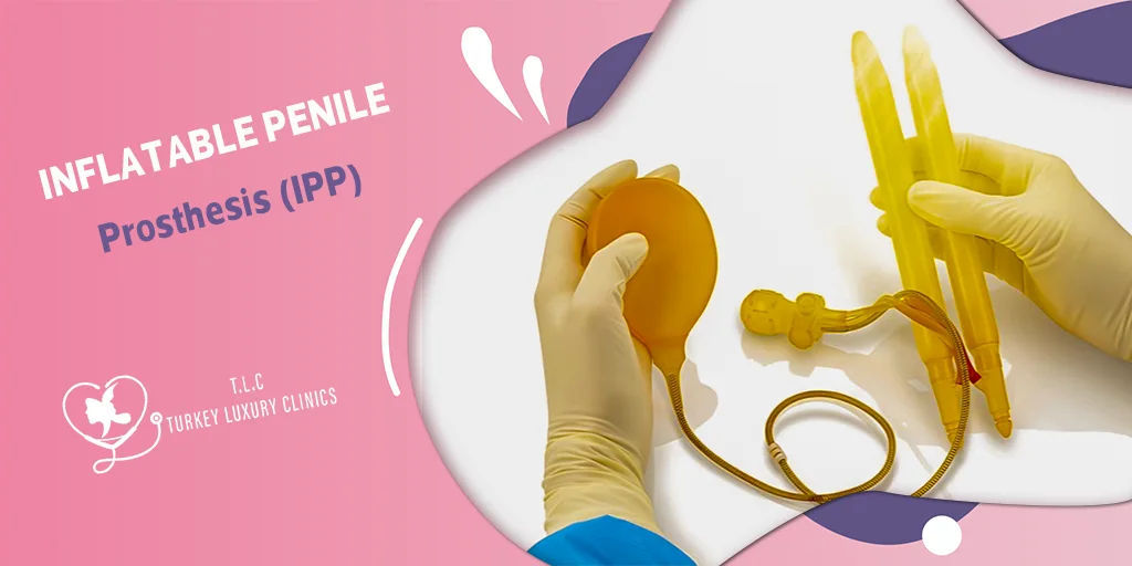 Prótesis Peneana Inflable (PPI): Desde $6,000